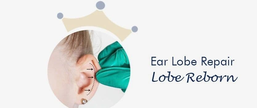 Ear lobe repair