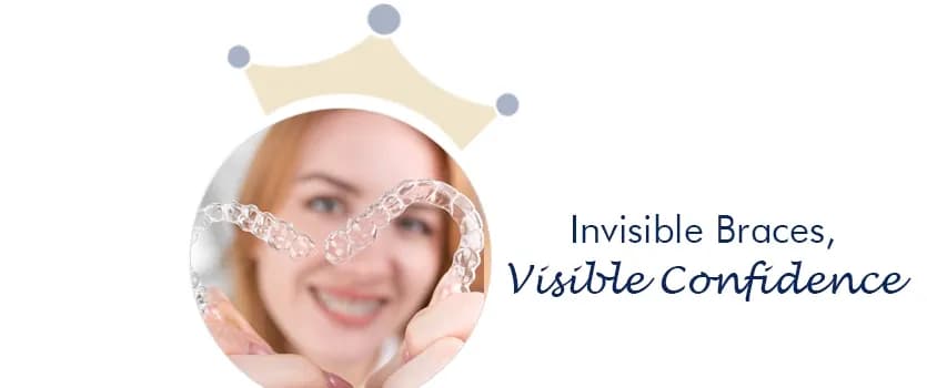 Invisalign Ahmedabad 