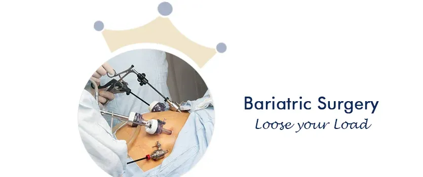 best Bariatric Surgery Ahmedabad 
