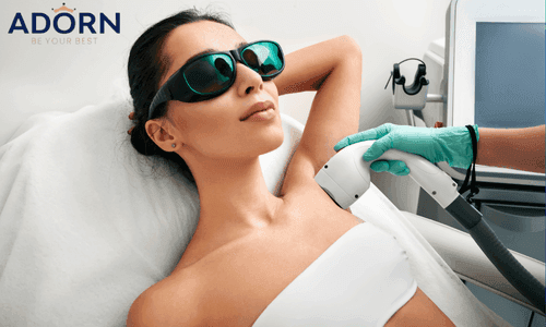 Laser Hair Removal Cost in Ahmedabad