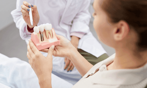 dental implant in Ahmedabad 