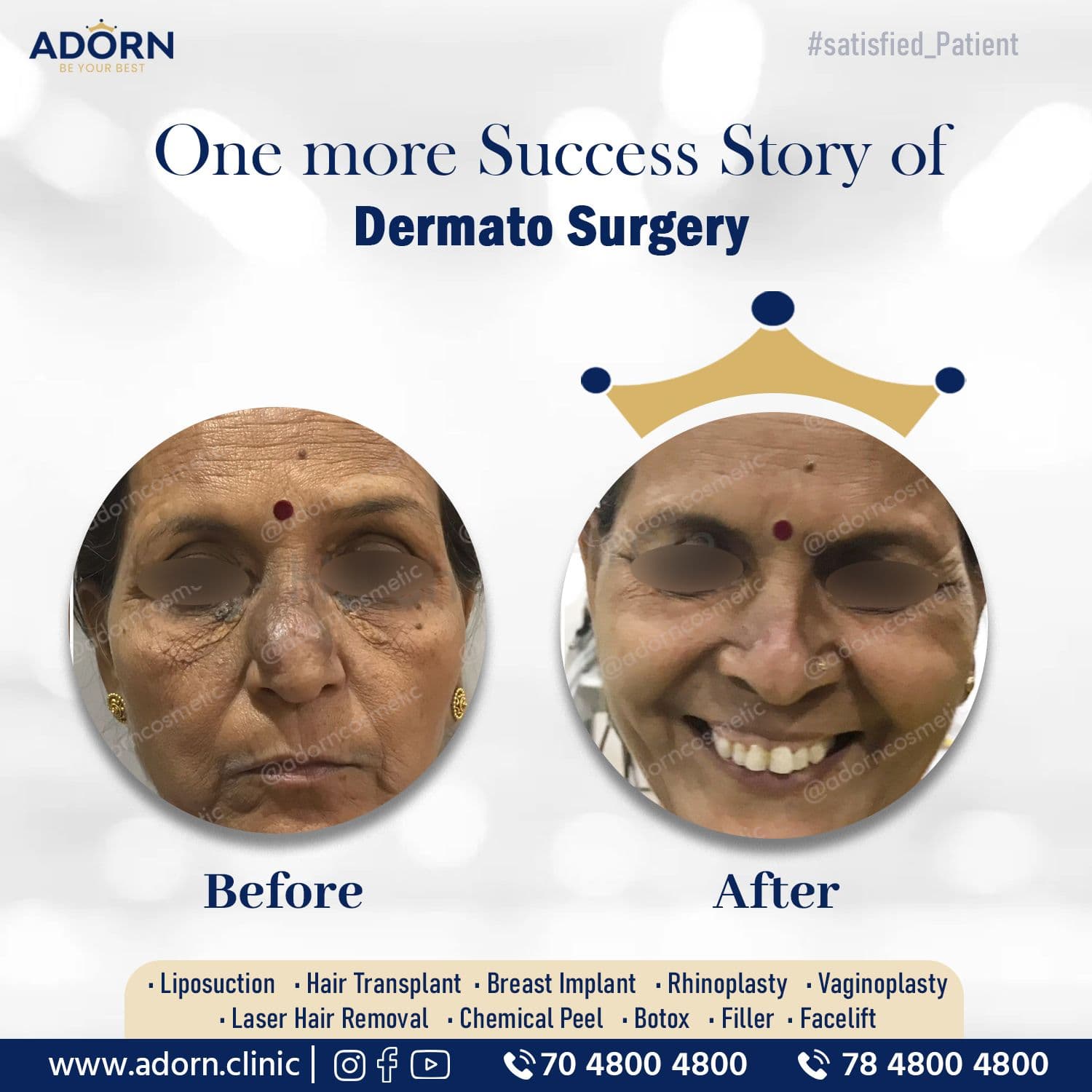 Dermato Surgery