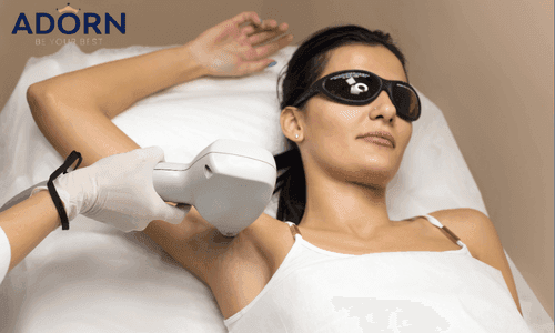 Step-by-Step: What to Expect on the Day of Your Laser Hair Removal Laser Hair Removal Treatment in ahmedabad
