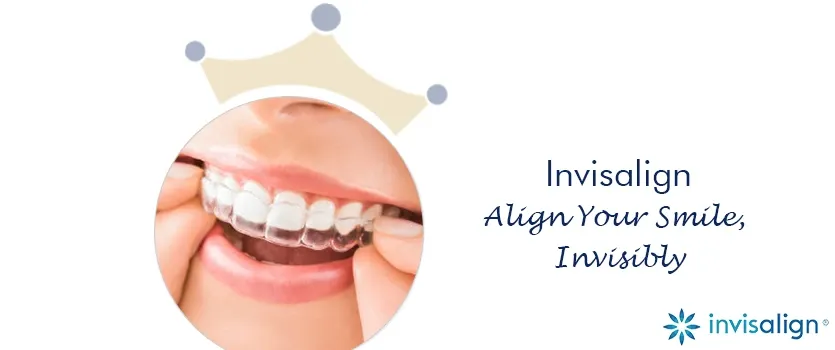 Invisalign Clear Braces Ahmedabad