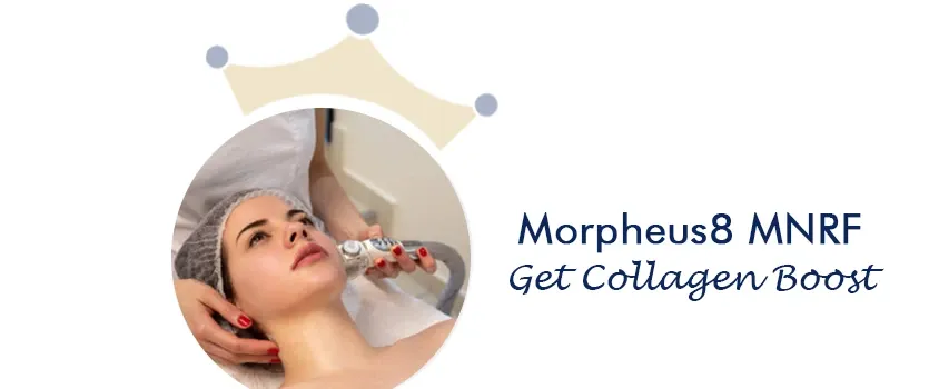 Morpheus8 MNRF india Ahmedabad