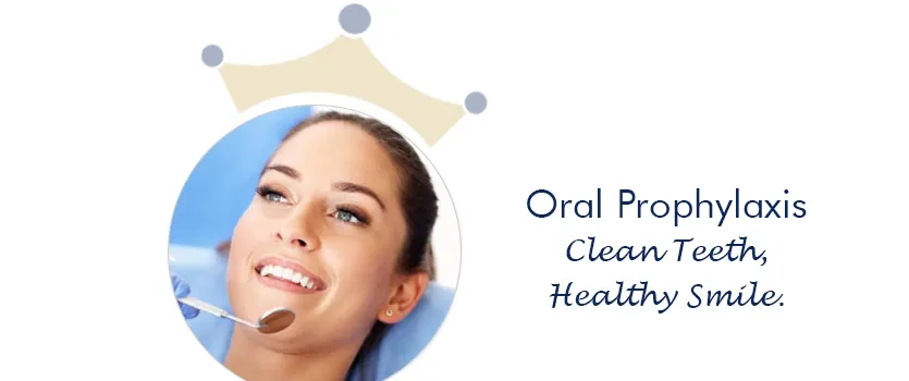 oral-prophylaxis in Ahmedabad