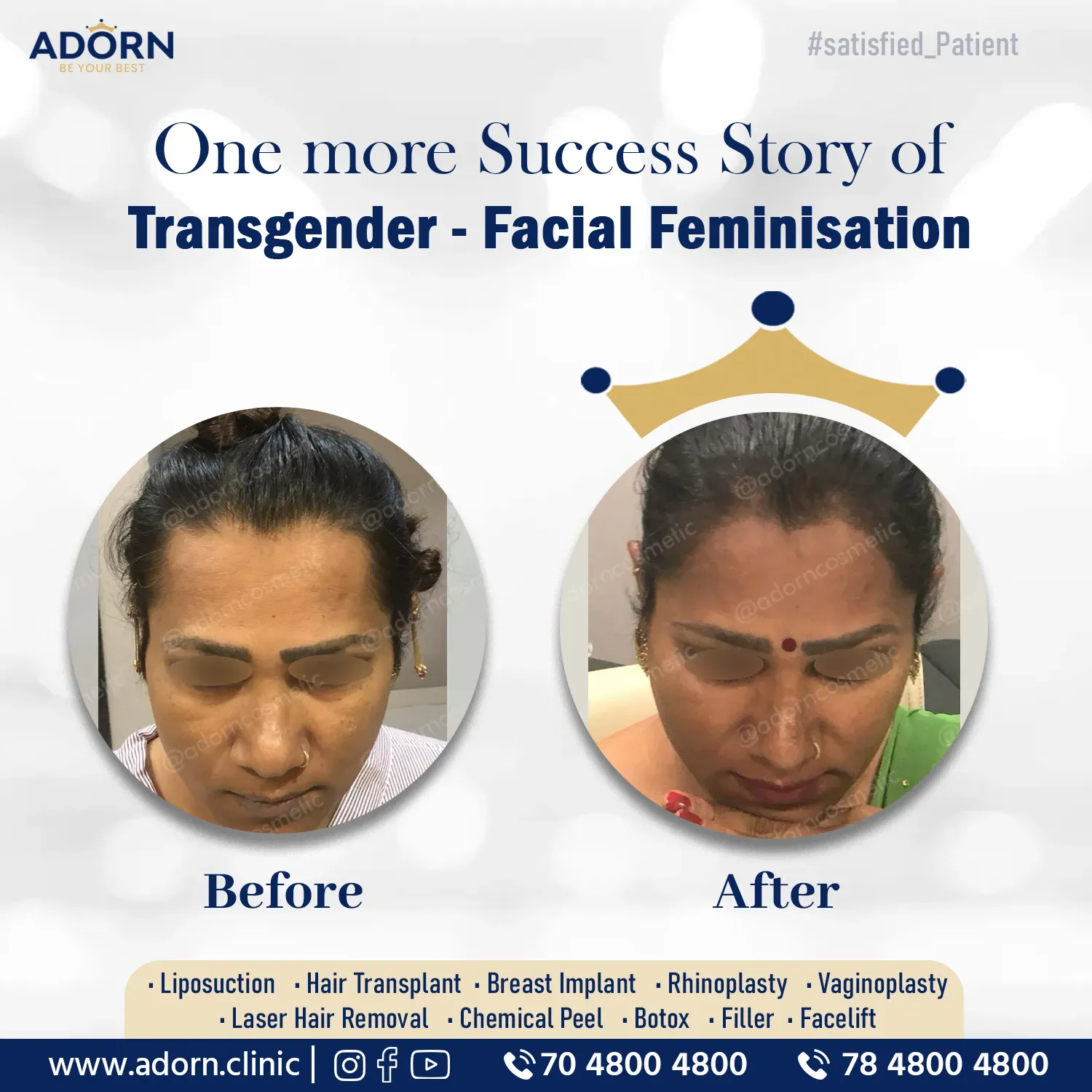 Trans Gender