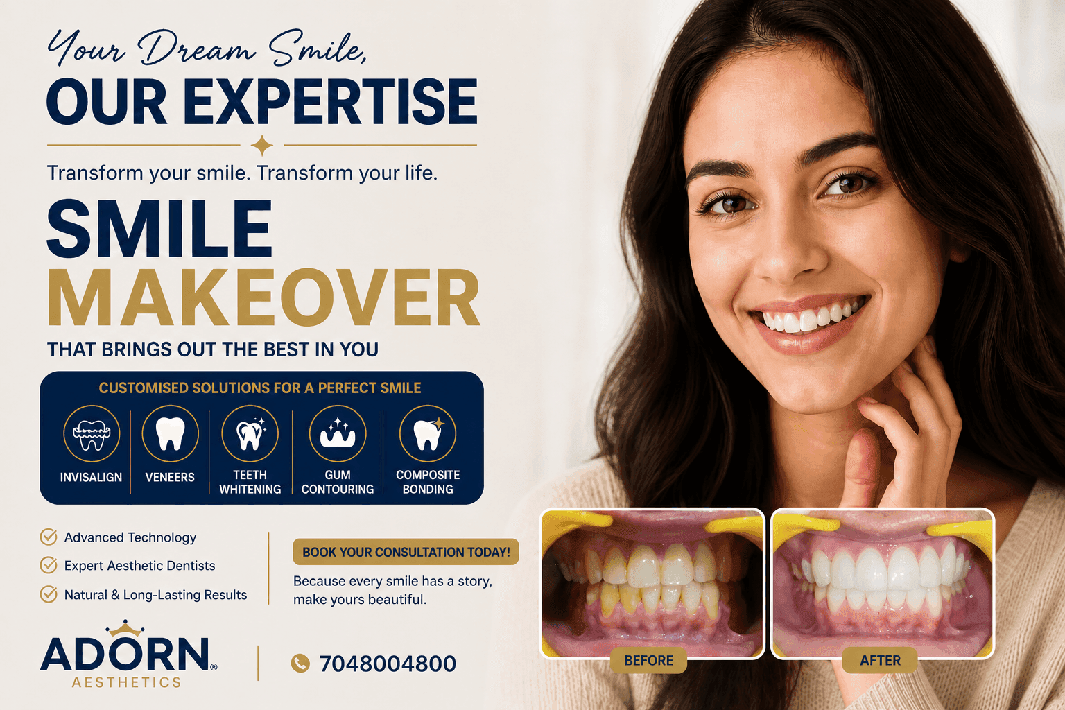 Smile Makeover in Ahmedabad: Invisalign, Veneers cost & Complete Dental Transformation at Adorn Aesthetics teeth-whitening-veneers-invisalign-ahmedabad